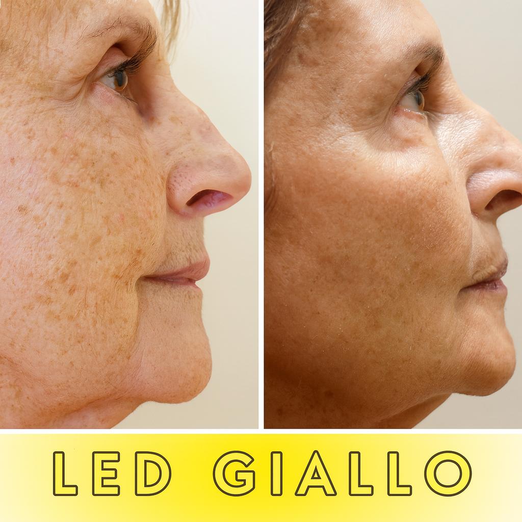 LUMINA SKIN - Effetto lifting naturale per una pelle più fresca e naturale.
