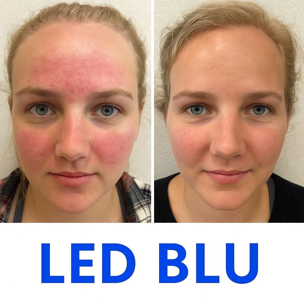 LUMINA SKIN - Effetto lifting naturale per una pelle più fresca e naturale.