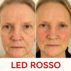 LUMINA SKIN - Effetto lifting naturale per una pelle più fresca e naturale.